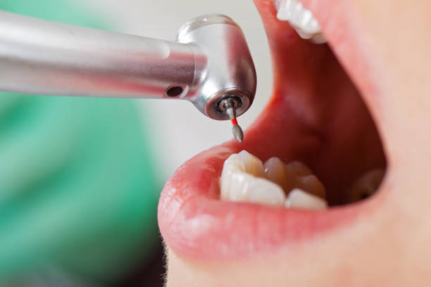 Best Emergency Denture Repair in Mill Plain, CT